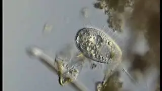 PLEURONEMA CILIADO