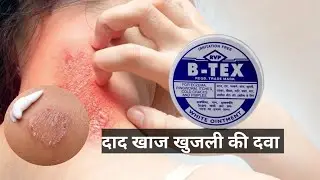 b tex cream for fungal infection B Tex Cream review