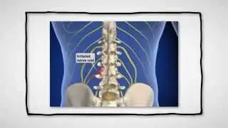 Hassel Family Chiropractic Des Moines Iowa
