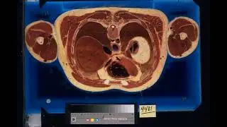 Visible Human Project Male video UHD/Виртуальная анатомическая модель тела человека - 20 кадров/с