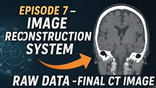 CT Episode 7 | Image Reconstruction System: Raw Data to Final CT Image
