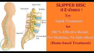 Slipped Disc Treatment | 100% Effective Home Based Slipped Disc Treatment
