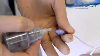 Preventing Blood Culture Contamination - Cannula Method