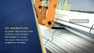 3D Accident Animation Depicts Operational Failure Causing Traumatic Fall Injuries