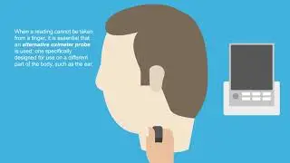 Risk of harm from inappropriate placement of pulse oximeter probes