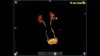How to MRI of Urogram || MRI Urogram || Urogram