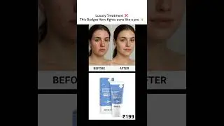 Acne to Clear Skin ✨ - Affordable Skincare That Works Fast! #shorts