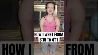 How I Went From 3&rsquo;10 To 4&rsquo;11 #shorts #dwarfism #limblengthening