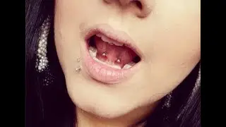✩ Nouveau piercing ➤ frein sublingual :)