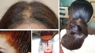 Say goodbye to hairfall with just ONE Ingredient | Grow Hair Faster