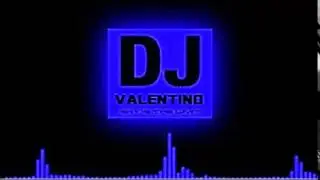 Ray das bist du Suit and Tie Remix New 2017