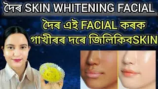 Skin whitening Facial ছাল বগা উজ্বল হব,কলা দাগ, শুকান ছাল, বয়সৰ চাপ দুৰ হব।।