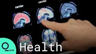 FDA Approves First New Alzheimer's Drug in Nearly 20 Years