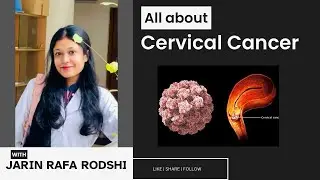 All about CERVICAL CANCER 
