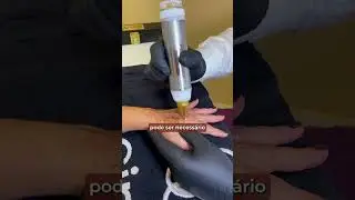 ACABE COM AS MANCHAS SENIS FAZENDO ESTE TRATAMENTO | O &Uacute;NICO 100% EFICAZ | CIMA'S EST&Eacute;TICA