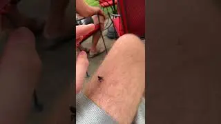 Jumping spider jumping