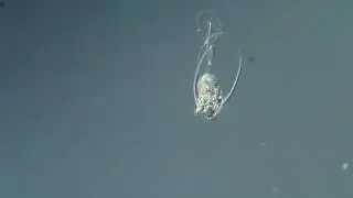 Time-Lapse: Rotifer Hatching from Egg by Mr. Moritz Klinghardt