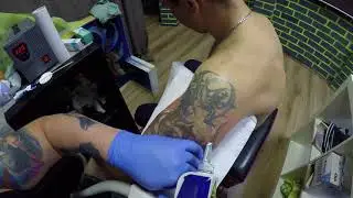 Первый Сеанс Удаления татуировки! Пигмент Гелевая ручка