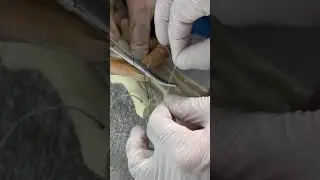 FAKE SURGERY! 😳🤯