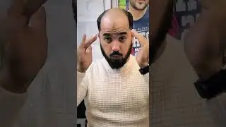 Customize Mens Toupee Hairpieces | Human Hair Replacement Wigs | Hi Toupee Hair Hairpiece