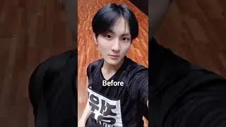 Proof jungwon had plactic surgery #kpop #haneulvibess #ehypen #engene #jungwon #jungcat #surgery