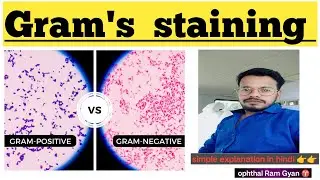 Gram's staining in hindi | gram staining technique | what is staining