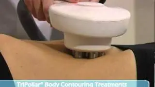 Tripollar Regen-xl for body contouring, facial sculpting, fat reduction, circumference reduction
