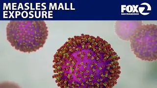 Thousands possibly exposed to measles at East Bay mall