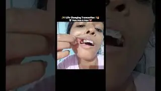 🔥❤️&zwj;🩹🦷Real life Smile Transformation || Braces Result #ytshorts #shorts #bracestransformation