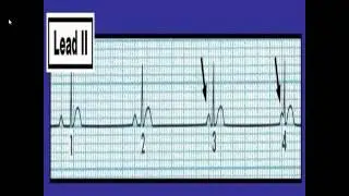 ECG Jeopardy