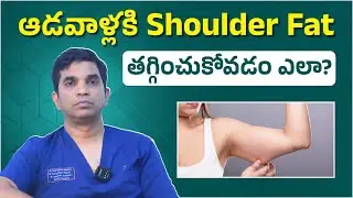 ఆడవారికి భుజాల దగ్గర కొవ్వు తగ్గించుకోవడం ఎలా? | How Women Can Reduce Shoulder Fat | Dr.Sasikanth