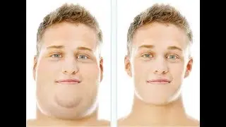 How to Get Rid of Neck Fat / MOST EFFECTIVE EXERCISES TO GET RID OF A DOUBLE CHIN