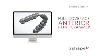 3Shape Splint Studio - Full coverage Anterior Deprogrammer - 02. Bite configuration