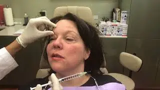 Bells Palsy Patient in New Jersey Shares Her Testimonial