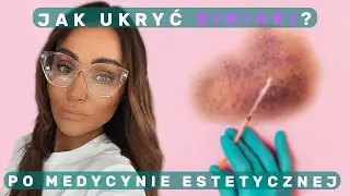 Jak ukryć siniaki po zabiegach medycyny estetycznej · Creo Academy Agnieszka Szeremeta