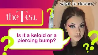 The Tea: Is it a Keloid or a Piercing Bump?