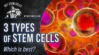 UMBILICAL CORD Stem Cells vs BONE MARROW or FAT DERIVED Stem Cells - Dr. Mark Fedorczyk