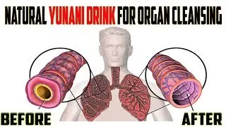 Lung Cleaning detox Ayurvedic Medicine -  Unani medicine for Lungs Cleaning