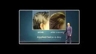 Jeunesse global RVL
