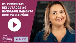[Aula VIP] Os principais resultados no microagulhamento contra calvície