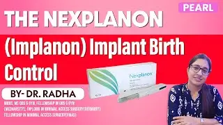 Implant Birth Control: Everything You NEED to Know About Nexplanon | By Dr. Radha | Pearl Academy