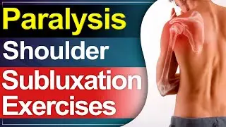 Paralysis Shoulder Subluxation Exercises | Shoulder Exercises in Paralysis | SRIAAS