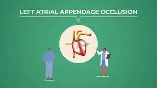 Left Atrial Appendage Occlusion (LAAO): A Life-Saving Alternative for AFib Patients