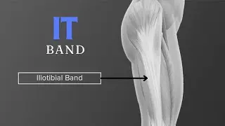 IT Band - Injuries and How to Strengthen Supporting Muscles