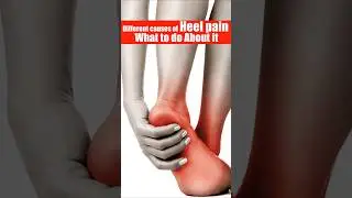 Heel Pain Relief in Seconds! 💥 | Causes, Treatment & Home Remedies Explained