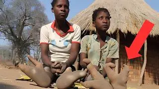 It's hard to believe! Two-fingered people with ostrich-like feet. Zimbabwe. Interesting facts