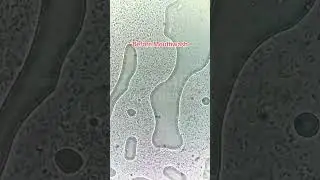 Mouthwash vs. millions of microbes! 🤯 See the microscopic battle! 🦠💦 #MouthwashMagic #BacteriaFight