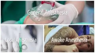 Three Types of Anesthesia Used in Plastic Surgery