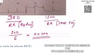 📚📖ECG All IMPORTANT QUESTIONS SESSION FOR UPCOMING NURSING EXAM 