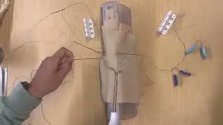 Aztron locking procedure